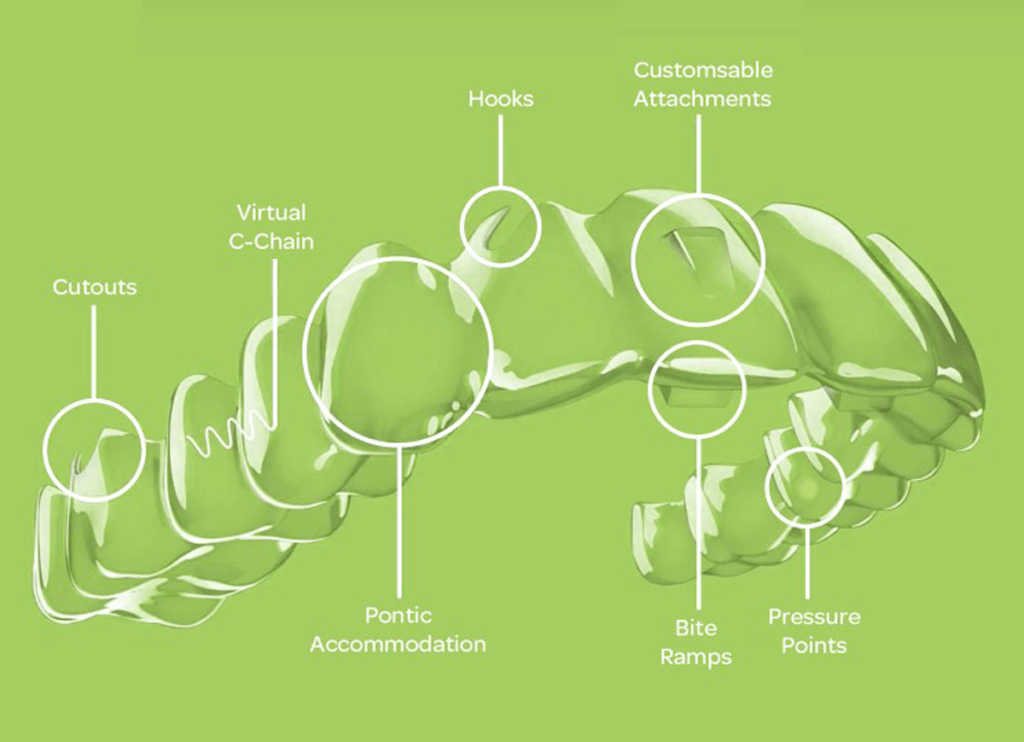 sdalign invisalign aligners