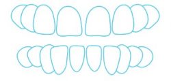 Gaps between teeth and space Gaps between teeth and space
